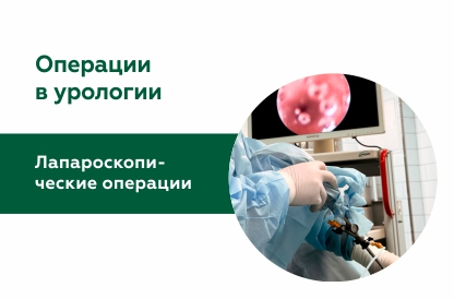 Лапароскопические операции в урологии