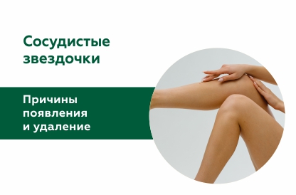 Лазерное удаление сосудистых звездочек
